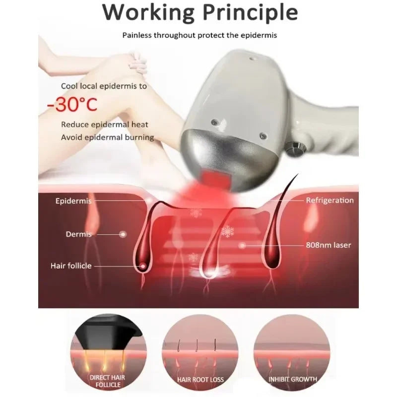 Diode Laser Hair Removal Professional Machine painless cooling permanent lazer hair removal 4 Wavelengths 755 808 940 1064