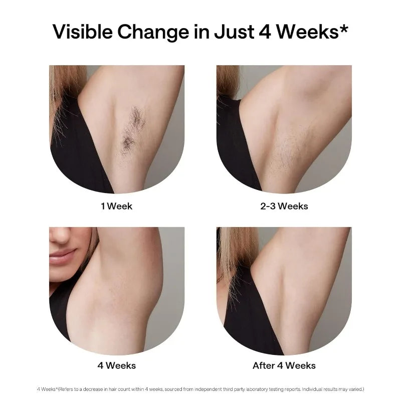 Ulike Laser Hair Removal for Women and Men, Air+ IPL Hair Removal Device with Ice-Cooling Technology for Nearly Painless Result