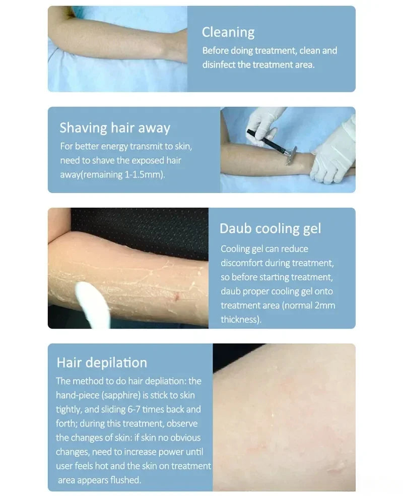 Diode Laser Hair Removal Professional Machine painless cooling permanent lazer hair removal 4 Wavelengths 755 808 940 1064