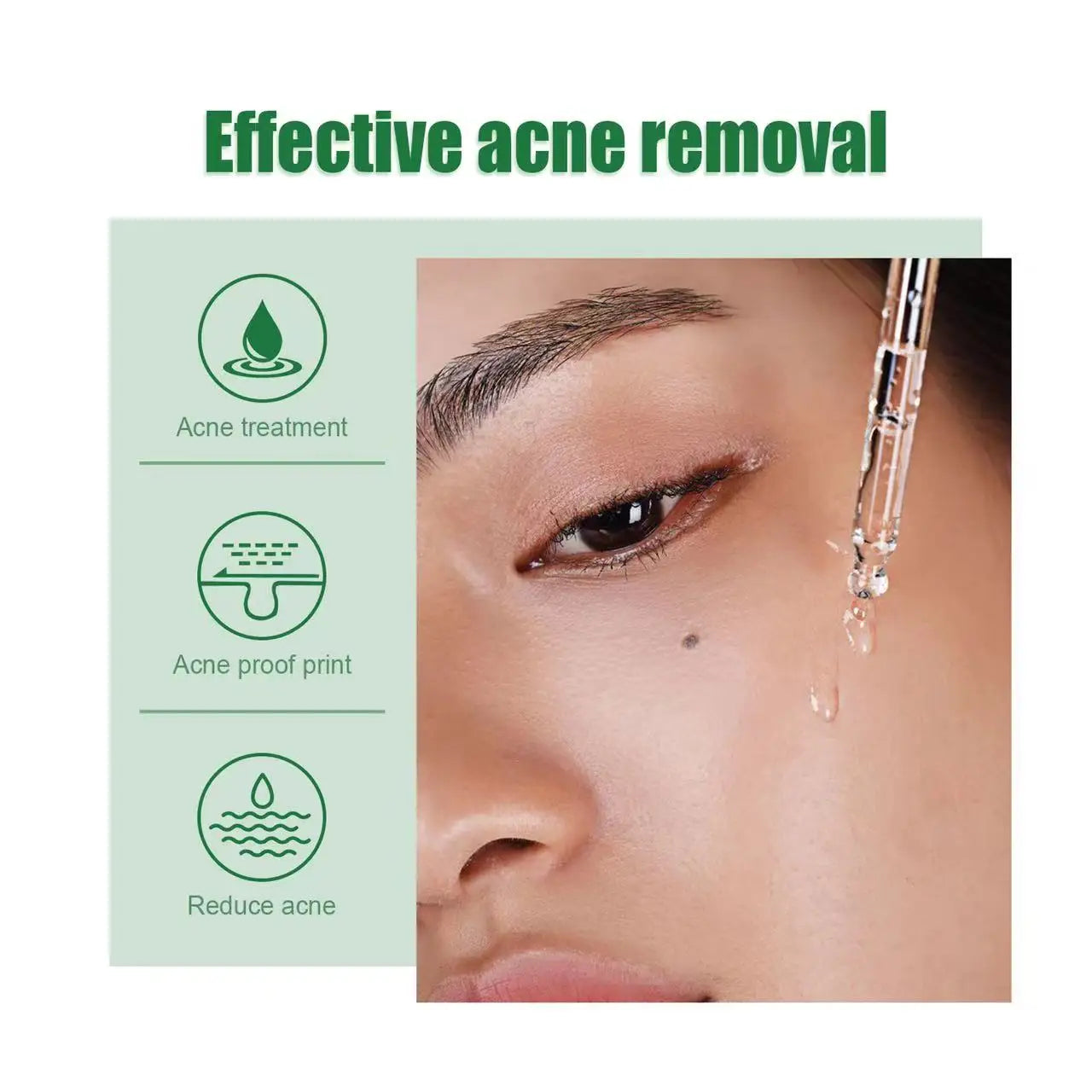 Acne Treatment Facial Serum Pore Shrinking Skin Care Against Face Acne Pimple Spots Remover Cleaning Shrink pores Tea Tree Serum