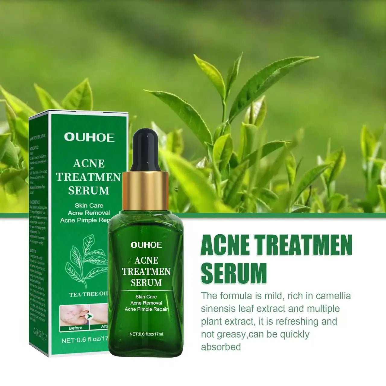 Acne Treatment Facial Serum Pore Shrinking Skin Care Against Face Acne Pimple Spots Remover Cleaning Shrink pores Tea Tree Serum