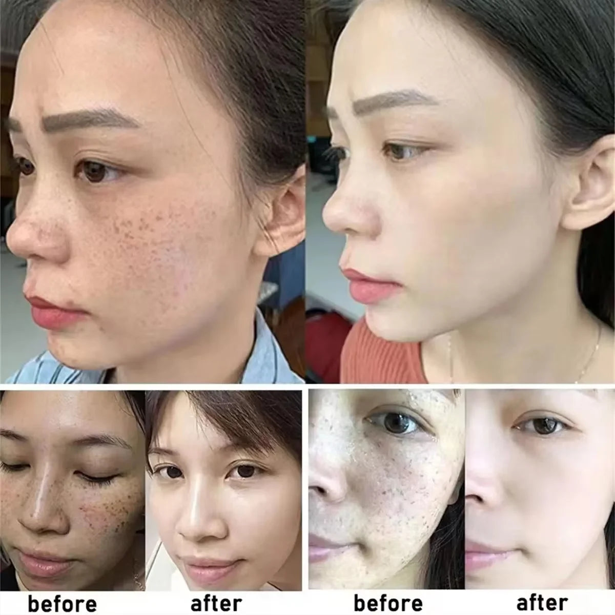 Dragon's Blood Face Cream Effective Whitening Freckles Remove Melasma Dark Spots Lighten Melanin Pigmentation Skin Care Cosmetic