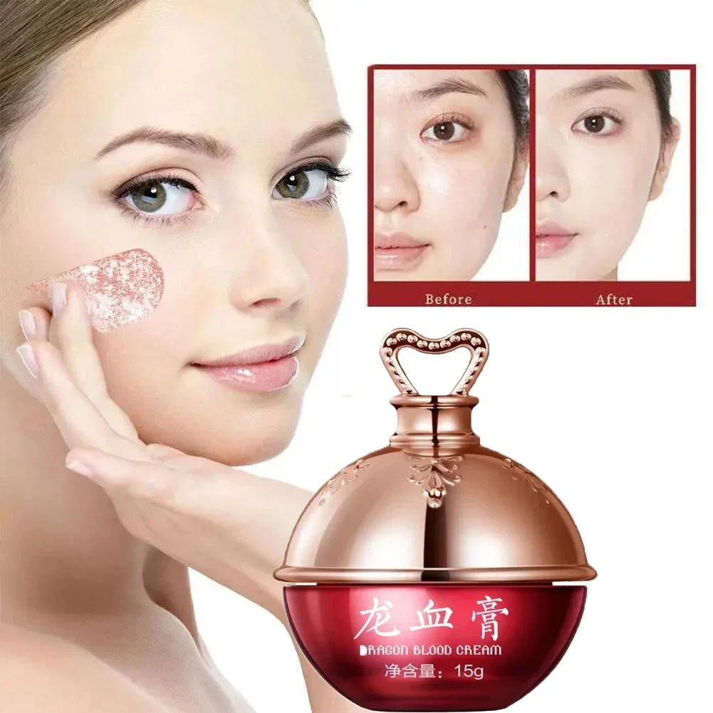 Dragon's Blood Face Cream Effective Whitening Freckles Remove Melasma Dark Spots Lighten Melanin Pigmentation Skin Care Cosmetic