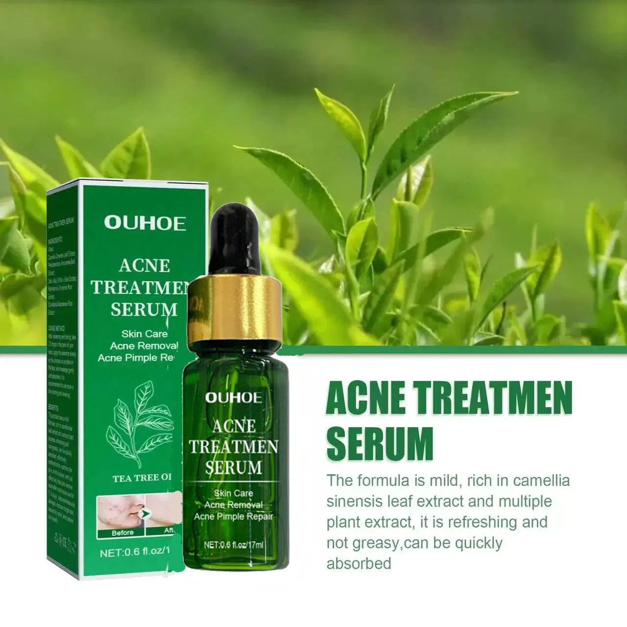 Acne Treatment Facial Serum Pore Shrinking Skin Care Against Face Acne Pimple Spots Remover Cleaning Shrink pores Tea Tree Serum