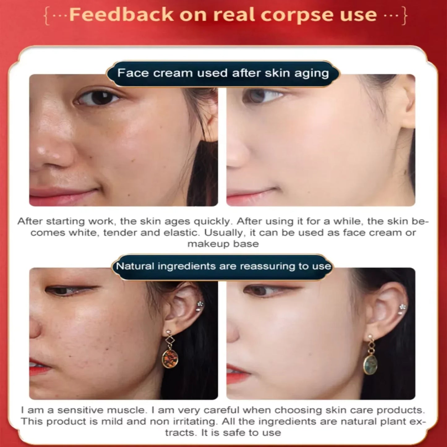 Dragon's Blood Face Cream Effective Whitening Freckles Remove Melasma Dark Spots Lighten Melanin Pigmentation Skin Care Cosmetic