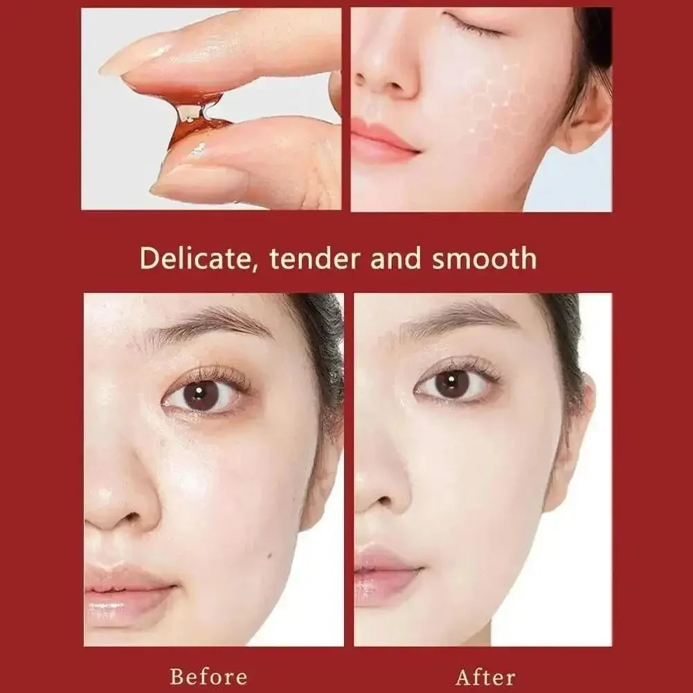 Dragon's Blood Face Cream Effective Whitening Freckles Remove Melasma Dark Spots Lighten Melanin Pigmentation Skin Care Cosmetic