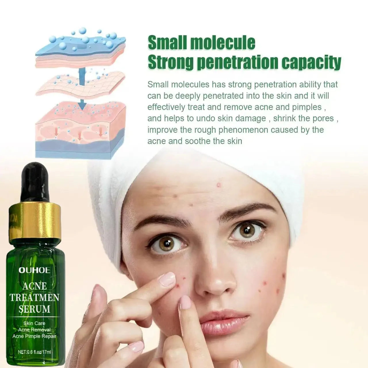 Acne Treatment Facial Serum Pore Shrinking Skin Care Against Face Acne Pimple Spots Remover Cleaning Shrink pores Tea Tree Serum