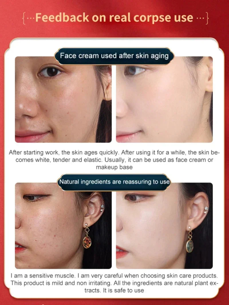 Dragon's Blood Face Cream Effective Whitening Freckles Remove Melasma Dark Spots Lighten Melanin Pigmentation Skin Care Cosmetic