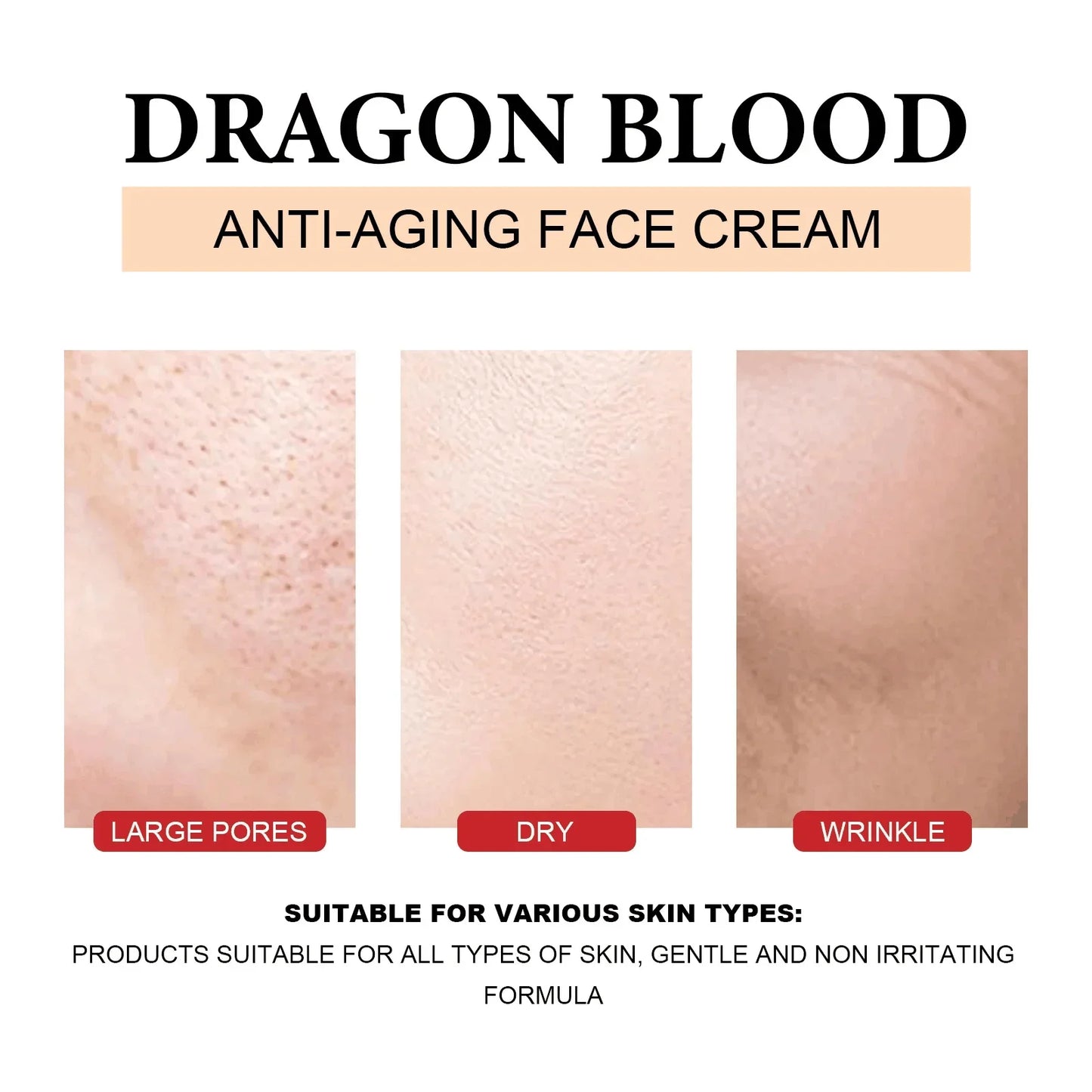 Dragon's Blood Face Cream Effective Whitening Freckles Remove Melasma Dark Spots Lighten Melanin Pigmentation Skin Care Cosmetic